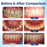 GUM CARE DROPS MOUTHWASH