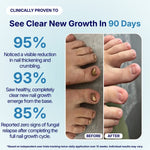 Your Nail Isn't Treatment-Resistant.